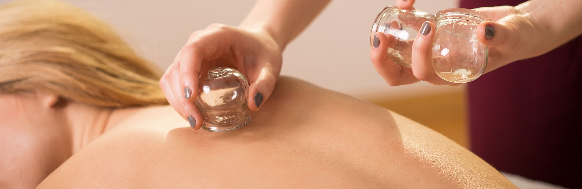 A women relaxing during our cupping massage services in Pasadena, CA.